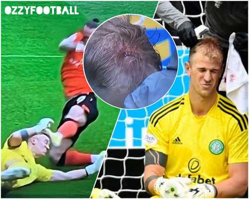 Джо Харт — боец дня Спорт, Футбол, Травма, Мужественность