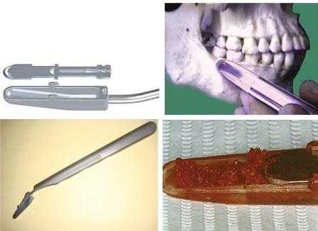 Техники забора и обработки костного материала