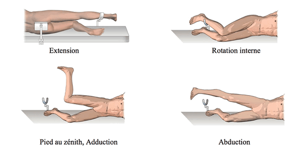 вытягивание -></p>
<p> поворот вовнутрь подъем стопы -> отведение 