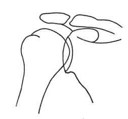 схема плеч-обраб