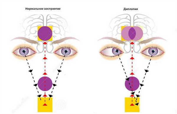 Двойное зрение