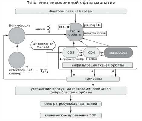 Патогенез эндокринной офтальмопатии