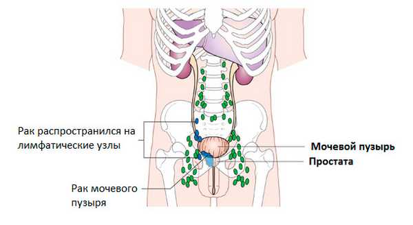 Лимфатические узлы органов таза