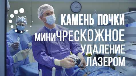 Лазерное дробление камней почки чрескожно. Миниперкутанная нефролитотрипсия (видео)