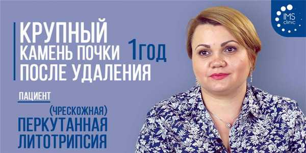 Перкутанная (чрескожная) литотриписия. Год после удаления коралловидных камней почек (видео)
