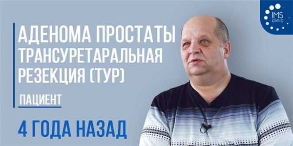 Аденома простаты. ТУР простаты (Трансуретральная резекция) 4 года назад. Видео отзыв