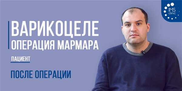 Варикоцеле. Операция Мармара. Отзыв. Видео отзыв