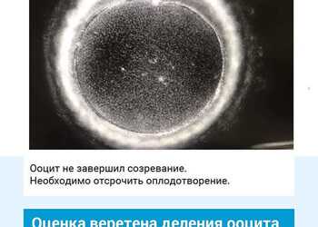 Оценка веретена деления яйцеклетки. Клиника ЭКО Альтравита.