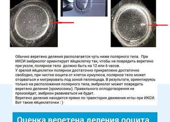 Оценка веретена деления яйцеклетки. Клиника ЭКО Альтравита.
