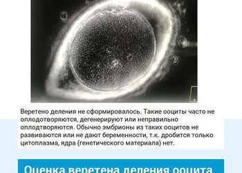 Оценка веретена деления яйцеклетки. Клиника ЭКО Альтравита.