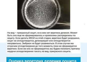 Оценка веретена деления яйцеклетки. Клиника ЭКО Альтравита.