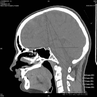 Описание: D:\Научные конференции и публикации\Конференции\2014\АПСМиФ-2014\Анатомия человека\Н.Р\image3.jpg