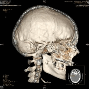 Описание: D:\Научные конференции и публикации\Конференции\2014\АПСМиФ-2014\Анатомия человека\Н.Р\image64677454.jpg