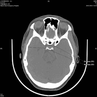 Описание: D:\Научные конференции и публикации\Конференции\2014\АПСМиФ-2014\Анатомия человека\Н.Р\image4.jpg