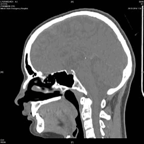 Описание: D:\Научные конференции и публикации\Конференции\2014\АПСМиФ-2014\Анатомия человека\Н.Р\image1.jpg