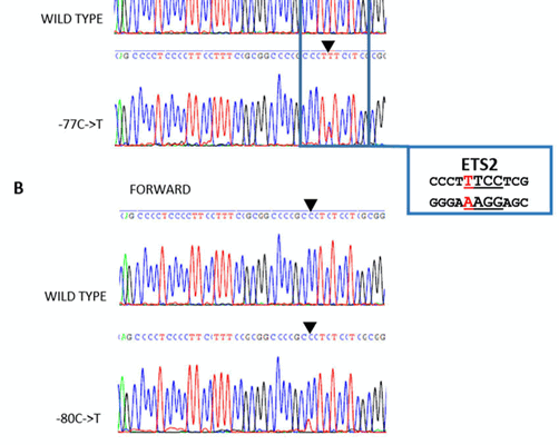 Генетическое исследование материала, полученного при биопсии узла щитовидной железы