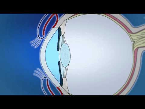 Видео Передняя и задняя камеры глаза