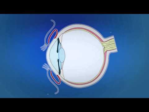 Видео Передняя и задняя камеры глаза