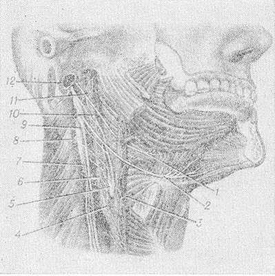 Рис. 1. Топография языкоглоточного нерва: 1— язычные ветви языкоглоточного нерва; 2 — подъязычный нерв; 3— наружная сонная артерия; 4— каротидный синус; 5— каротидный гломус; в— внутренняя сонная артерия; 7— блуждающий нерв; 8— верхний шейный симпатический узел; 9— нижний узел блуждающего нерва; 10— синусная ветвь языкоглоточного нерва; 11— языкоглоточный нерв; 12— внутренняя яремная вена (отсечена).