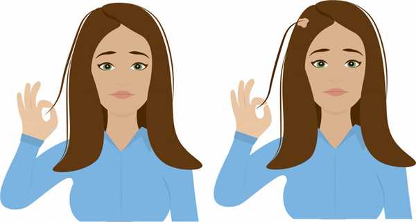 Трихотилломания