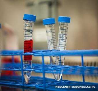 Гормональное исследование: глобулин связывающий половые гормоны