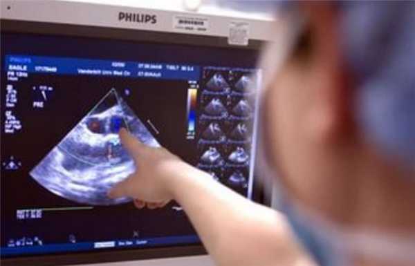 трансвагинальное узи матки