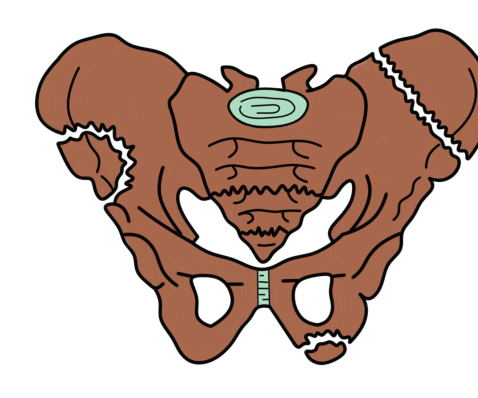 Расхождение костей после родов