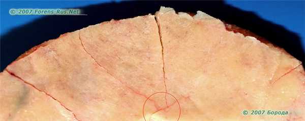Вид части внутренней компактной пластинки