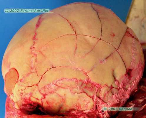 Вид части внутренней компактной пластинки