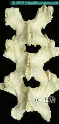 Повреждения остистых отростков при переезде колесом автомобиля