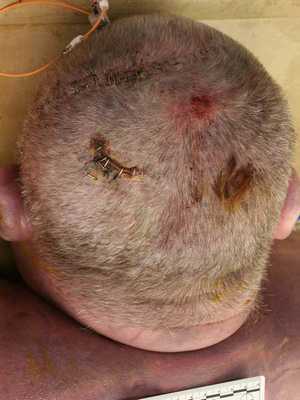 Внешний вид кожных покровов