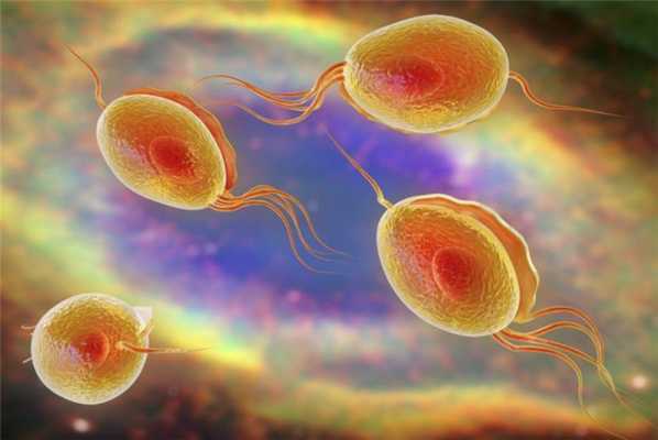 трихомониаз