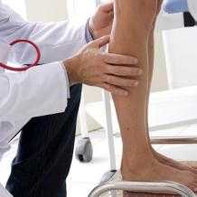 Кто такой флеболог и что он лечит?