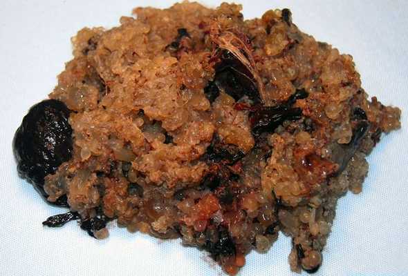 Ткани пузырного заноса