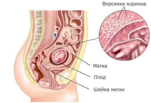 Ворсинки хориона в норме
