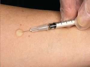 оценка реакции на пробу у ребёнка