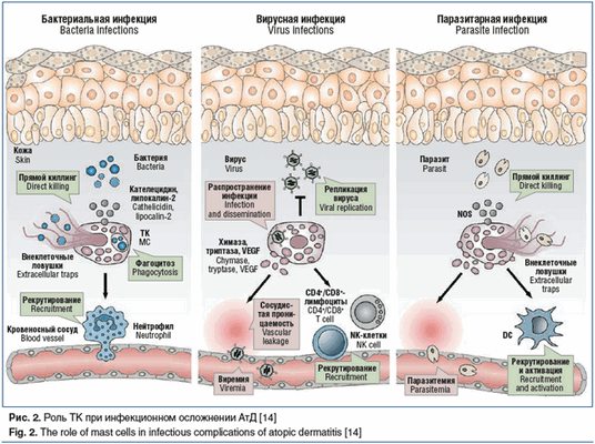 Рис. 2. Роль ТК при инфекционном осложнении АтД [14] Fig. 2. The role of mast cells in infectious complications of atopic dermatitis [14]