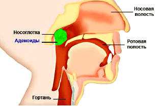 Ангина миндалины