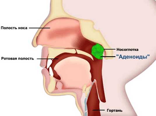 Отличие миндалин, гланд и аденоидов