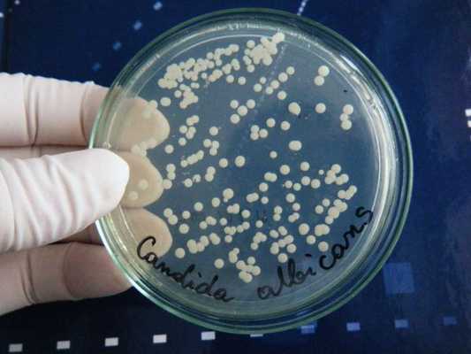 Грибы рода Candida на питательной среде