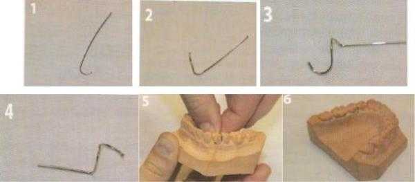 Вид фиксации кламмера адамса