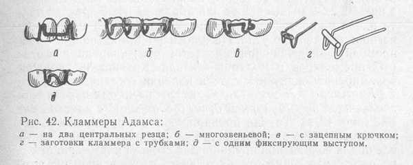 кламмер Адамса