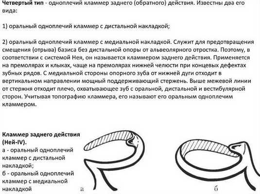 Типы кламмеров нея