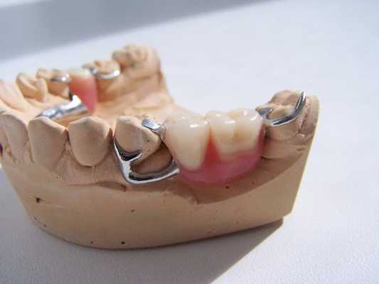 Основные виды кламмеров и их назначение