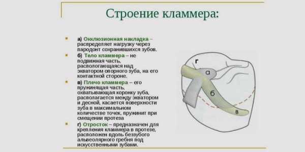 Виды кламмеров в ортопедической стоматологии