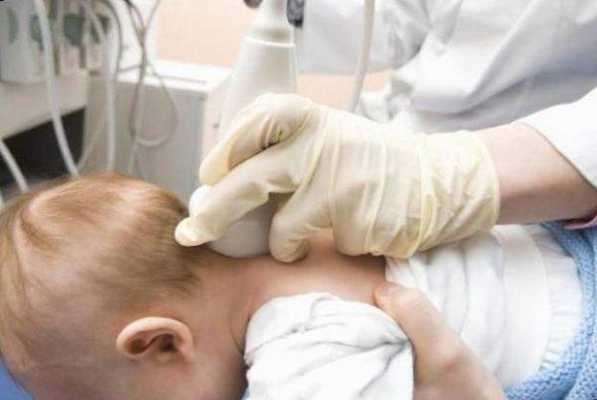 Диагностика шейного подвывиха