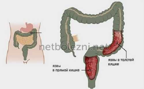 Какие болезни определяет рентген