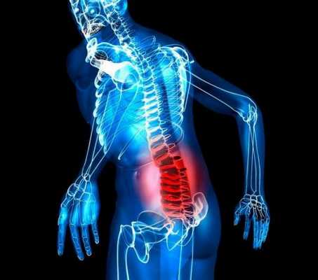 Смещение позвонков приносит, конечно, сильную боль, но избавиться от нее можно