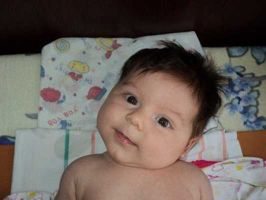 Шейный подвывих у ребенка