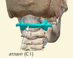 Подвывих атланта 